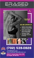 Erase Laser Tattoo Removal