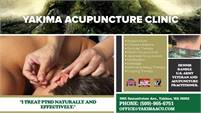 Yakima Acupuncture Clinic